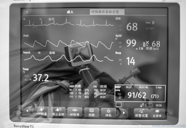 《延续生命》（组照）